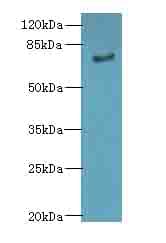 IHC-plus™ Polyclonal Rabbit anti-Human LRRN3 Antibody (IHC, WB)