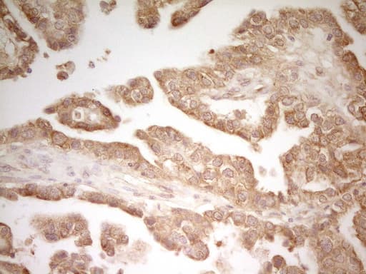 Monoclonal Mouse anti-Human PAK4 Antibody (clone OTI1C7, aa1-308, IHC, WB)