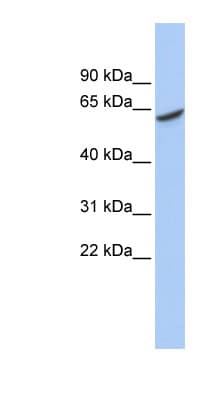 ADPGK Antibody (C-Terminus)