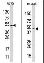 HIF1AN Antibody (aa286-316)