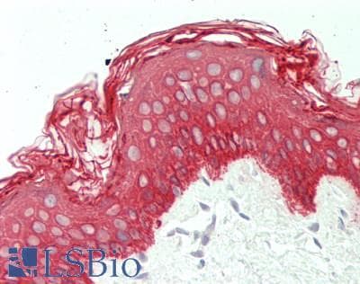 IHC-plus™ KRT5 / CK5 / Cytokeratin 5 Antibody (clone 4H8)