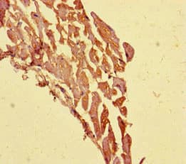 Polyclonal Rabbit anti-Human TECPR1 Antibody (IHC, IF)