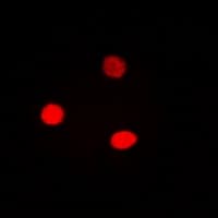 CCNE1 / Cyclin E1 Antibody