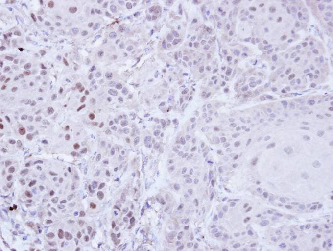 Polyclonal Rabbit anti-Human ZNF165 Antibody (aa129-461, IHC, WB)