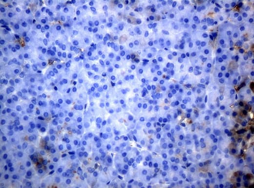 HP / Haptoglobin Antibody (clone UMAB10, Carrier-free)