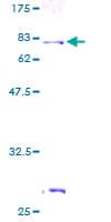 Human AIPL1 Protein (Recombinant GST)