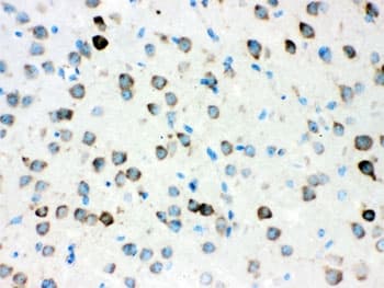ATXN2 / SCA2 / Ataxin-2 Antibody