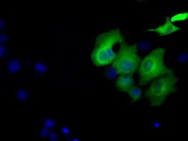SORD / Sorbitol Dehydrogenase Antibody (clone OTI9G9)