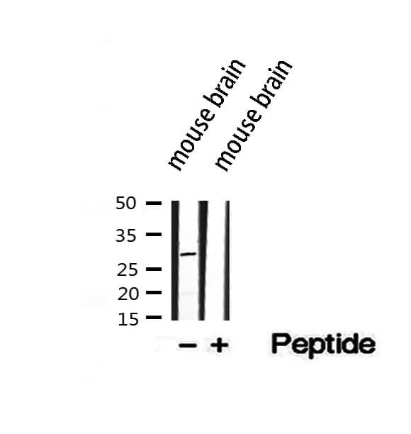 ETFB Antibody