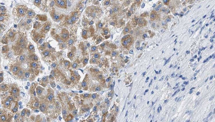 BLNK Antibody