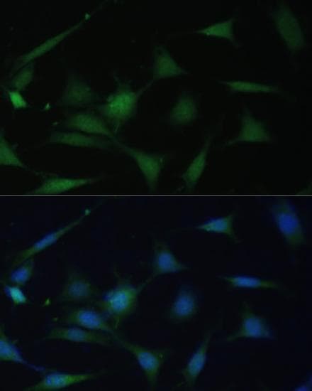MAPK14 / p38 Antibody