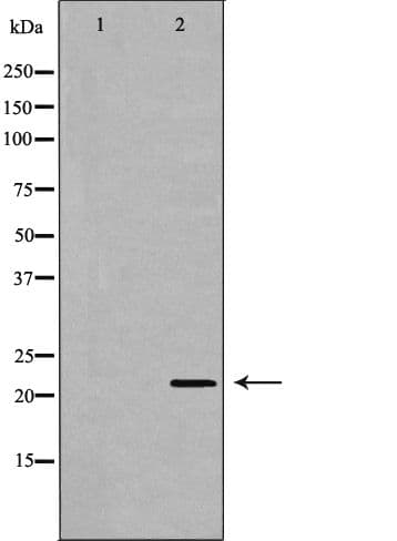 Polyclonal Rabbit anti-Human NUDT1 / MTH1 Antibody (IHC, IF, WB)