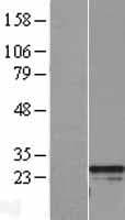 RGS2 Protein (Over-Expression Lysate Myc-DDK (Flag))