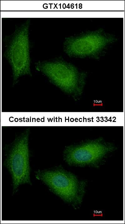 TPI1 / TPI Antibody (aa187-249)