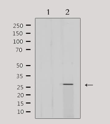 Polyclonal Rabbit anti-Human MRPL16 Antibody (IHC, IF, WB)