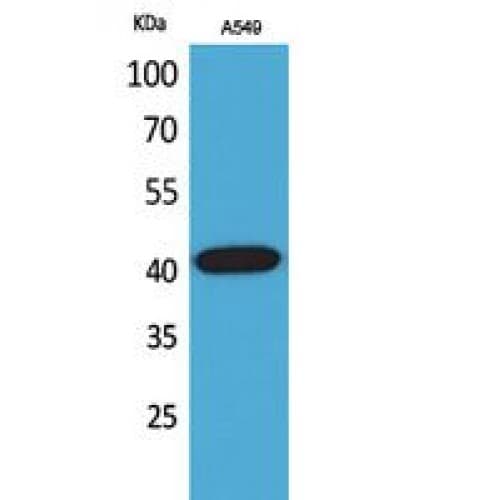 SELL / L-Selectin / CD62L Antibody (Internal)