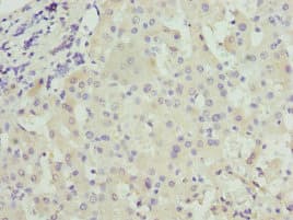 CRP / C-Reactive Protein Antibody