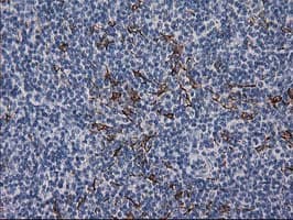 DES / Desmin Antibody (aa104-391, clone 4G1, Carrier-free)