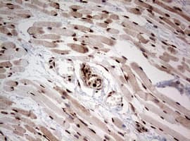 Monoclonal Mouse anti-Human NUMB Antibody (clone OTI2F1, aa1-365, IHC, WB)