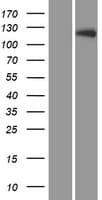 LTK Protein (Over-Expression Lysate Myc-DDK (Flag))