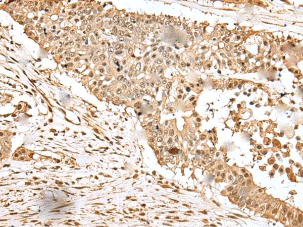 EEF1E1 / AIMP3 Antibody