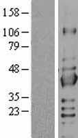SIRT2 / Sirtuin 2 Protein (Over-Expression Lysate Myc-DDK (Flag))
