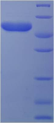 Human CLVS2 Protein (Recombinant His-SUMO)