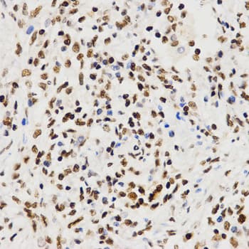 Polyclonal Rabbit anti-Human Histone H3 Antibody (IHC, IF, WB)