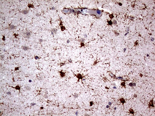 Monoclonal Mouse anti-Human NPAS1 Antibody (clone OTI1C9, aa319-522, IHC, WB)