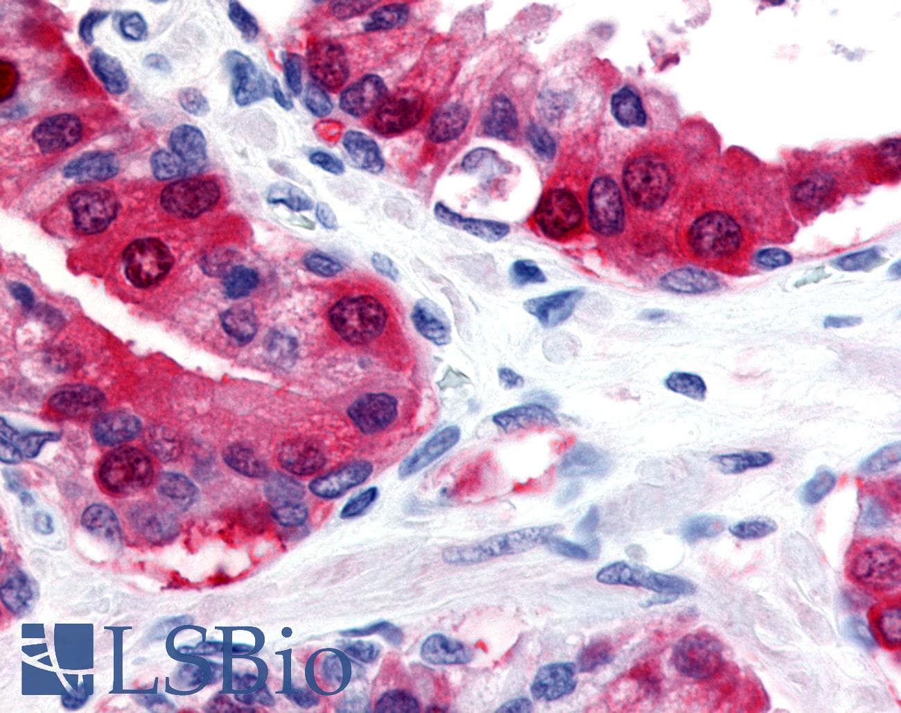 PathPlus™ Polyclonal Rabbit anti-Human TRPM8 Antibody (Internal, IHC)