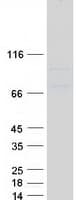 Human HMMR / CD168 / RHAMM Protein (Recombinant Myc-DDK (Flag))