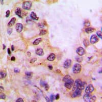 Polyclonal Rabbit anti-Human CYP39A1 Antibody (C-Terminus, IHC, WB)