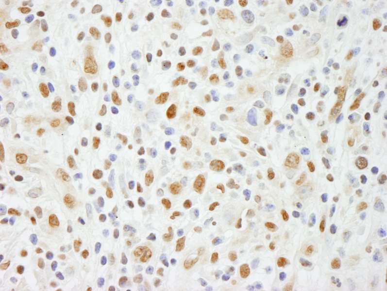 Polyclonal Rabbit anti-Human ZNF335 / NIF1 Antibody (aa1300-C-term, IHC, WB)