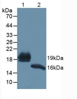 REG1B Antibody (aa23-166, APC)