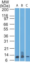 S100A8 / MRP8 Antibody (aa2-105, clone 48M7F9)