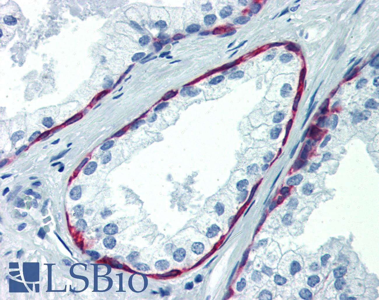 PathPlus™ KRT17 / CK17 / Cytokeratin 17 Antibody (C-Terminus, clone V21-R)