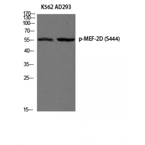 MEF2D Antibody (380-460 aa)