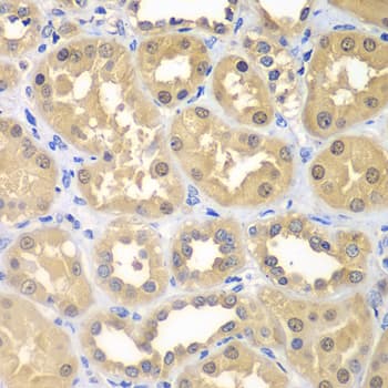 Polyclonal Rabbit anti-Human KHK / Ketohexokinase Antibody (IHC, WB)