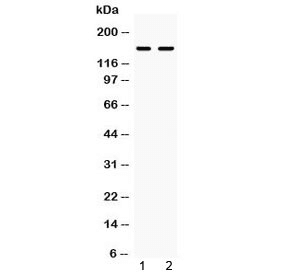 Polyclonal Rabbit anti-Human ITGAL / CD11a Antibody (WB)