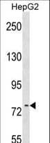 Polyclonal Rabbit anti-Human TIF-IA / RRN3 Antibody (aa277-305, WB)