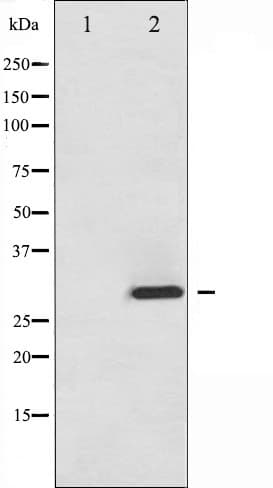 ATF1 Antibody (phospho-Ser63)