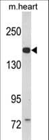 Polyclonal Rabbit anti-Human CORIN Antibody (aa459-490, WB)