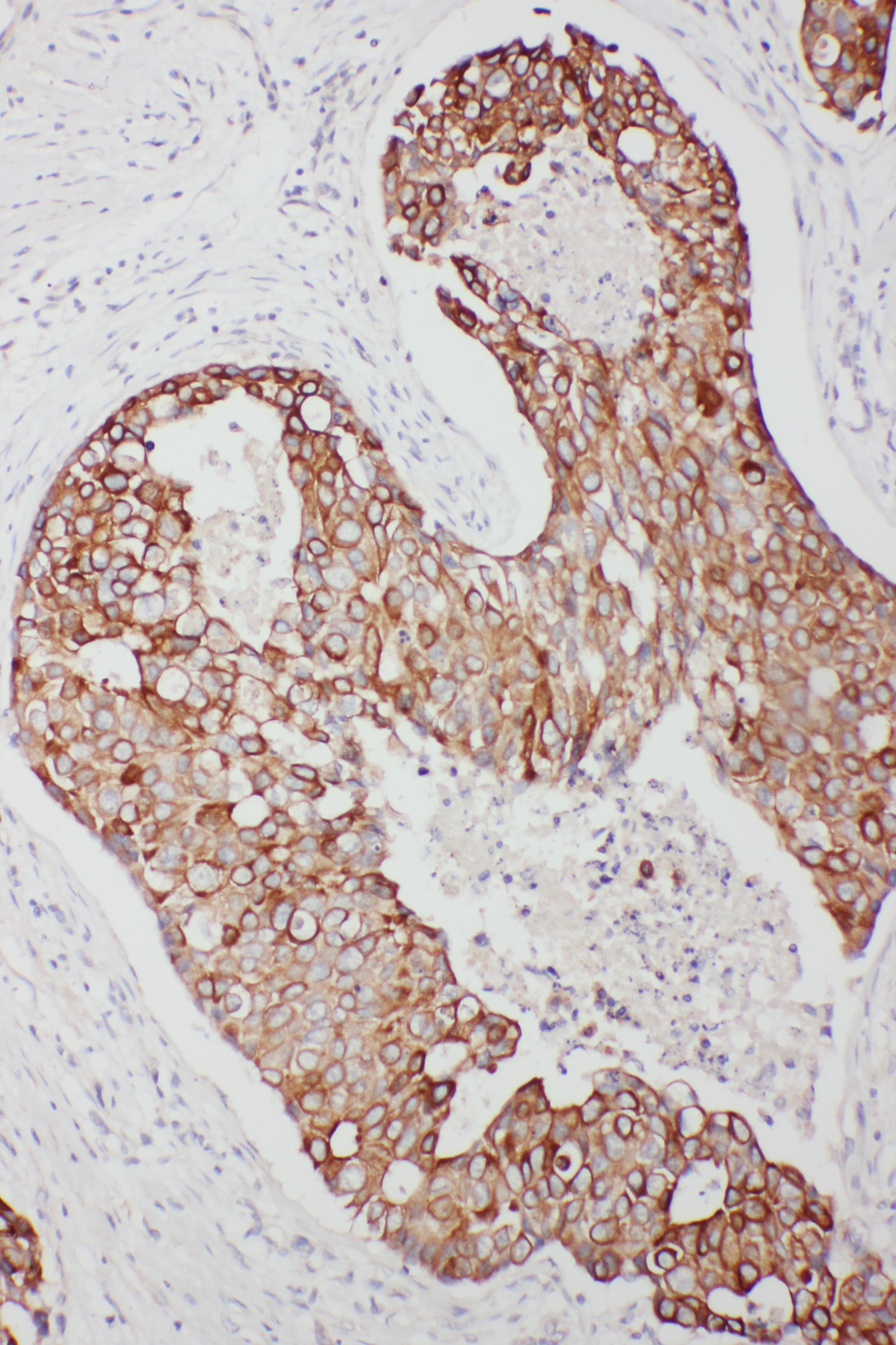 TNFAIP8L3 Antibody (aa273-292)