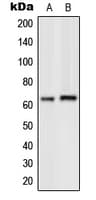 GRK7 / GPRK7 Antibody (Internal)