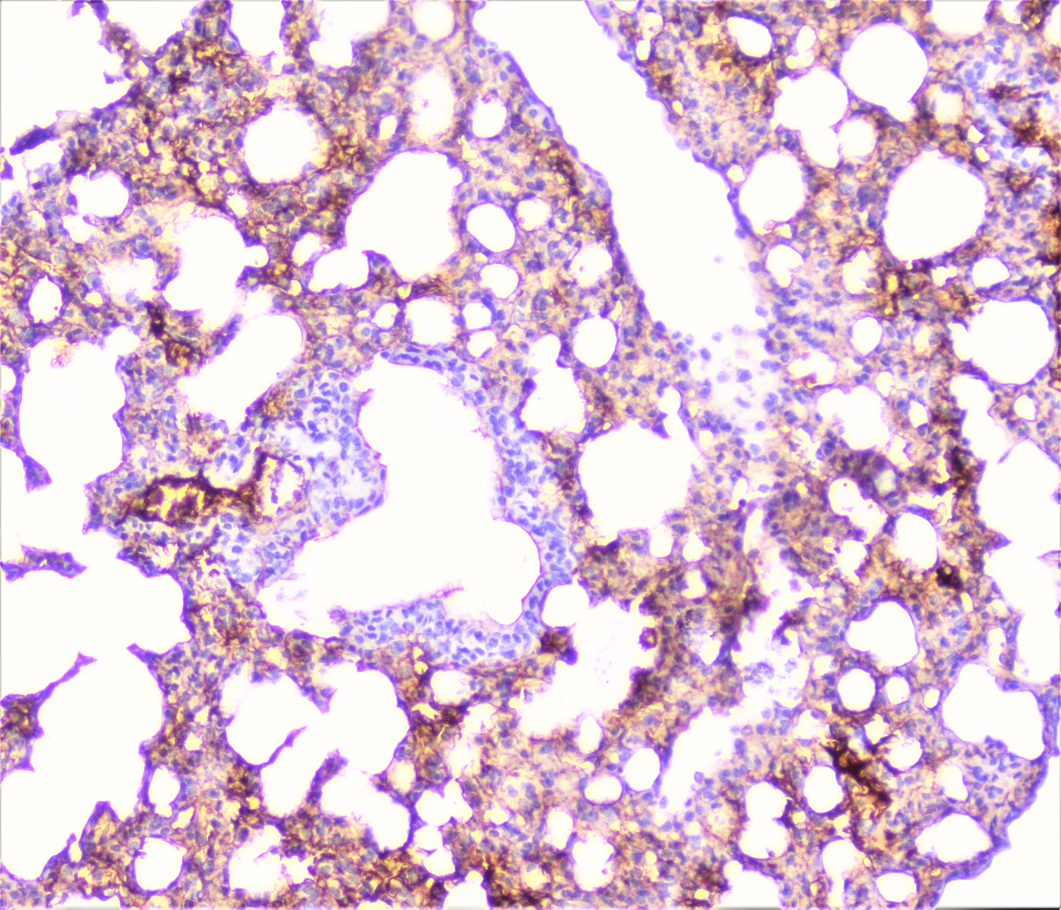 TNFRSF1A / TNFR1 Antibody