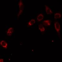 Polyclonal Rabbit anti-Human SMPX Antibody (IF, WB)