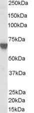 IHC-plus™ Polyclonal Goat anti-Human TOM1L2 Antibody (aa494-507, IHC, WB)