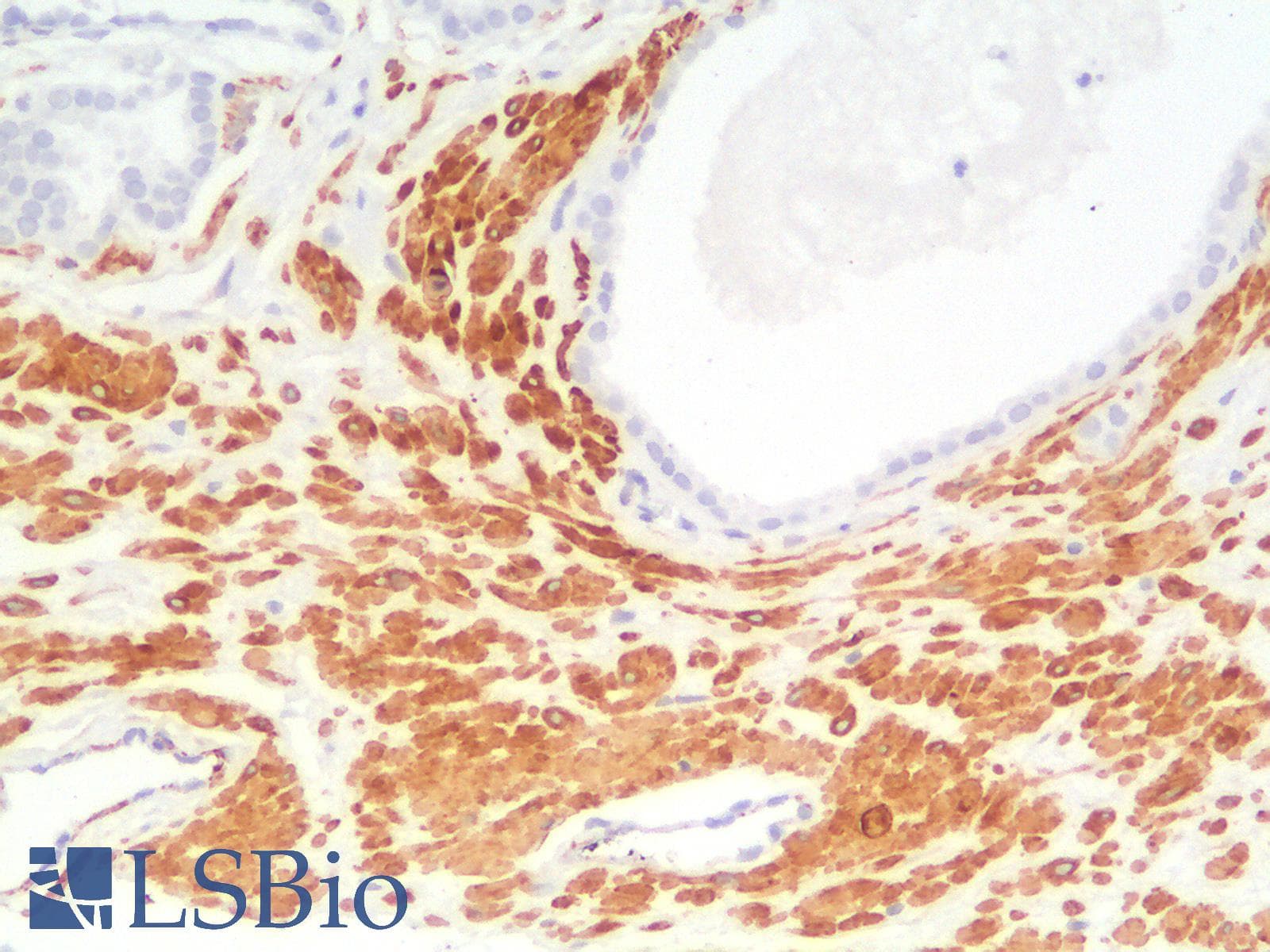 PathPlus™ SMMHC / MYH11 Antibody (clone MYH11/2303R)