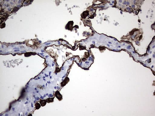 IHC-plus™ Acidic Cytokeratin Antibody (clone 1D10)