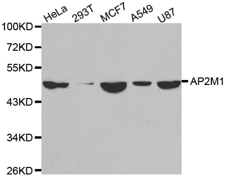 Polyclonal Rabbit anti-Human AP50 / AP2M1 Antibody (IHC, WB)